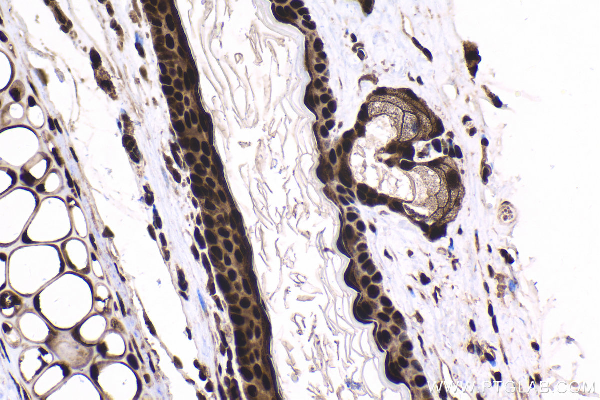 Immunohistochemical analysis of paraffin-embedded mouse skin tissue slide using KHC1650 (CSNK2B IHC Kit).