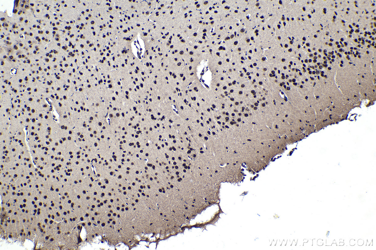 Immunohistochemical analysis of paraffin-embedded mouse brain tissue slide using KHC1580 (CSTF2 IHC Kit).