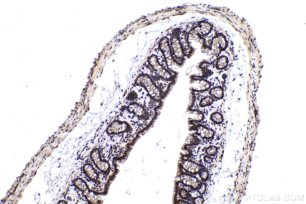 Immunohistochemical analysis of paraffin-embedded rat colon tissue slide using KHC0945 (CTBP1 IHC Kit).