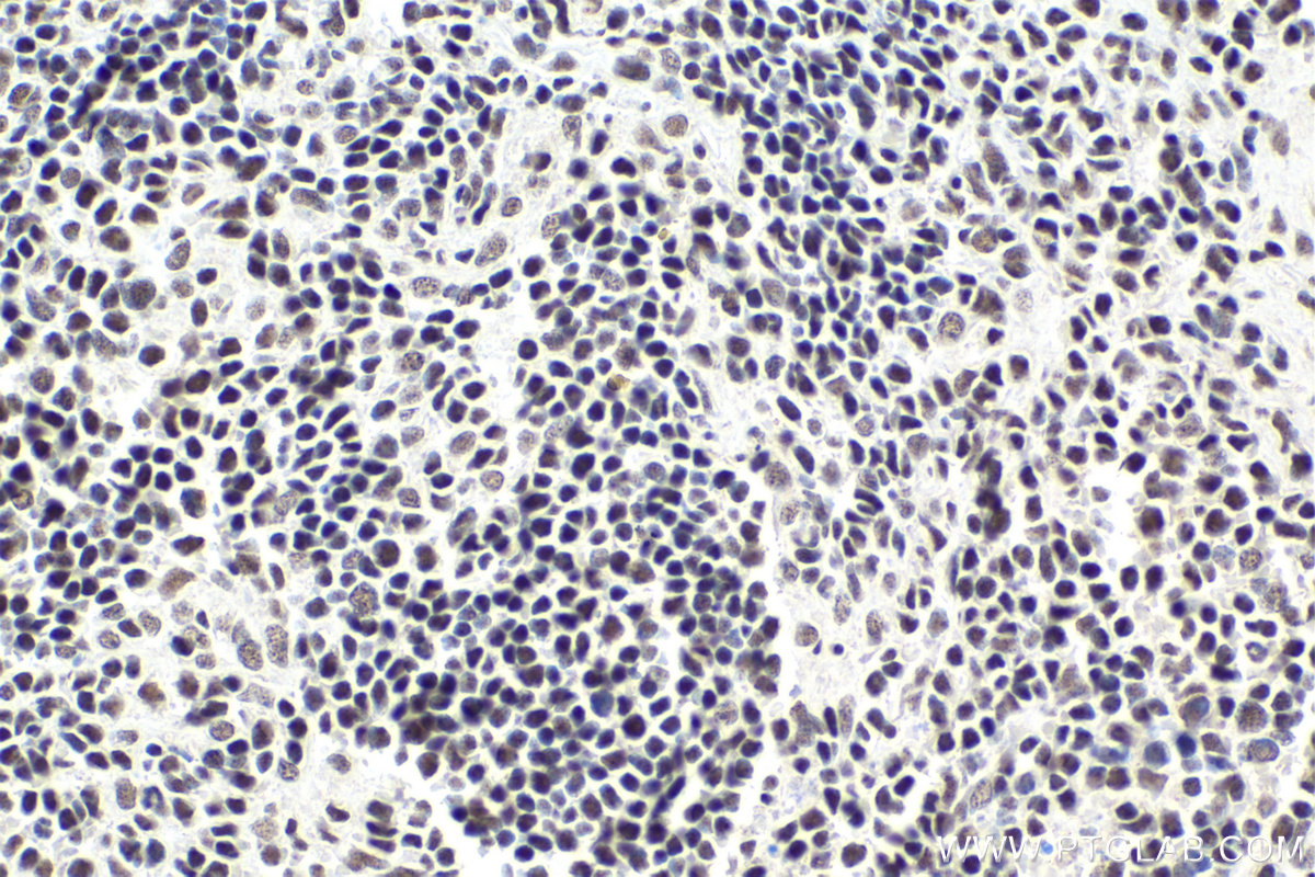 Immunohistochemical analysis of paraffin-embedded mouse spleen tissue slide using KHC1613 (CTCF IHC Kit).