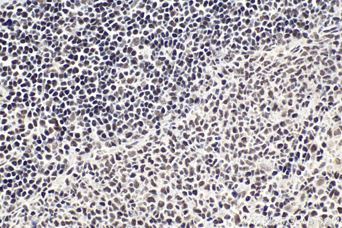 Immunohistochemical analysis of paraffin-embedded rat spleen tissue slide using KHC1613 (CTCF IHC Kit).