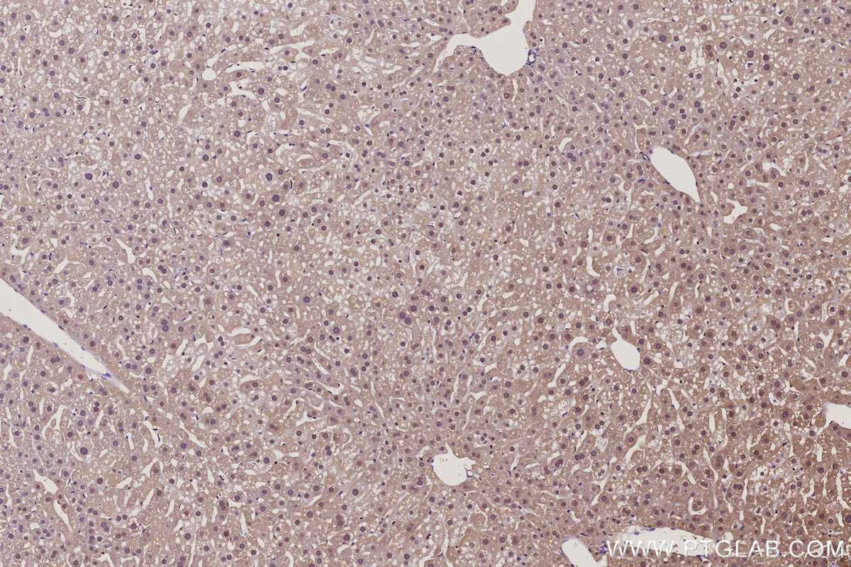 Immunohistochemical analysis of paraffin-embedded mouse liver tissue slide using KHC3100 (CTDSPL2 IHC Kit).