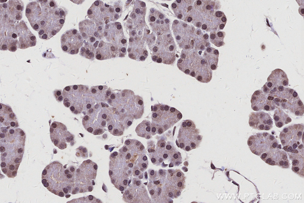 Immunohistochemical analysis of paraffin-embedded rat pancreas tissue slide using KHC3100 (CTDSPL2 IHC Kit).