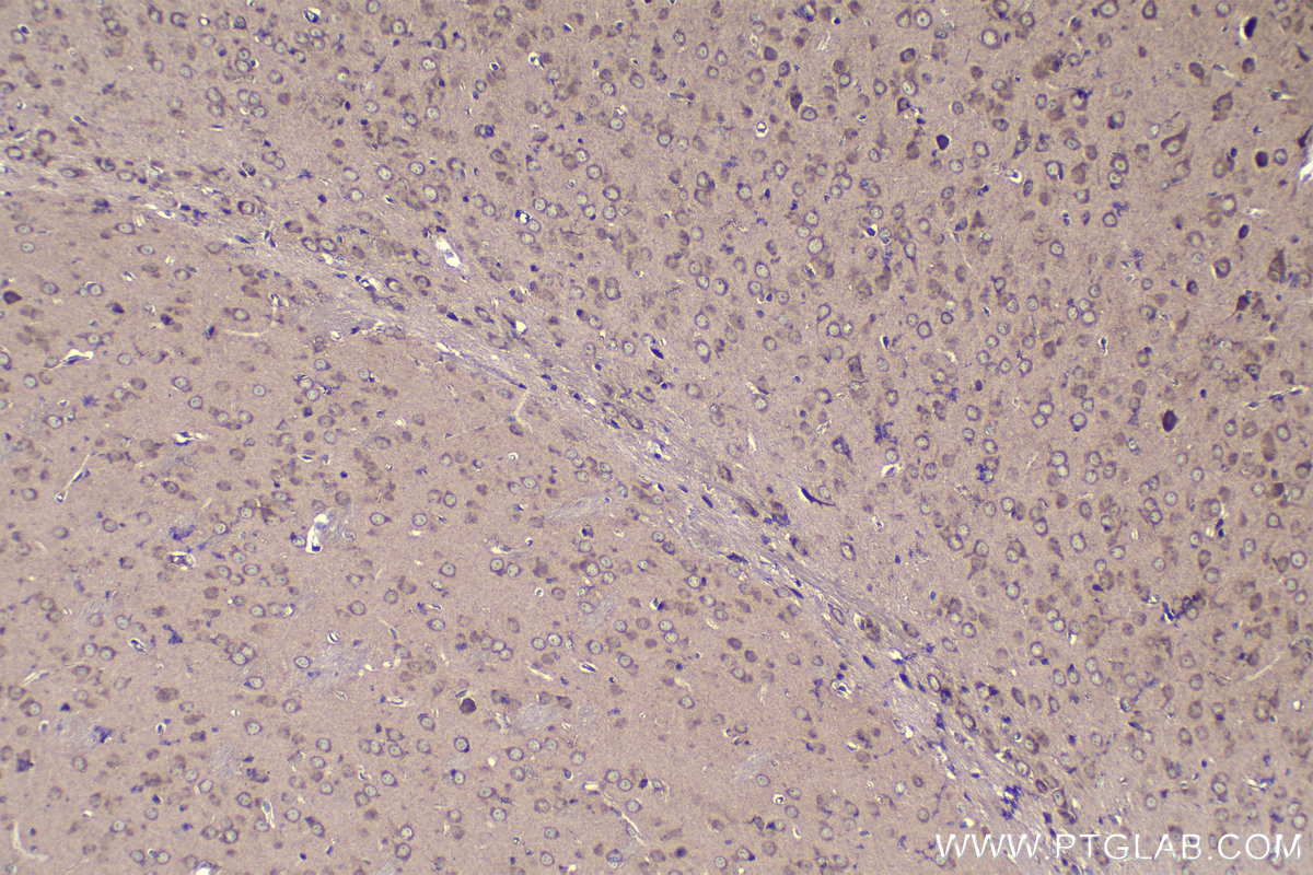 Immunohistochemical analysis of paraffin-embedded mouse brain tissue slide using KHC1108 (CTGF/CCN2 IHC Kit).