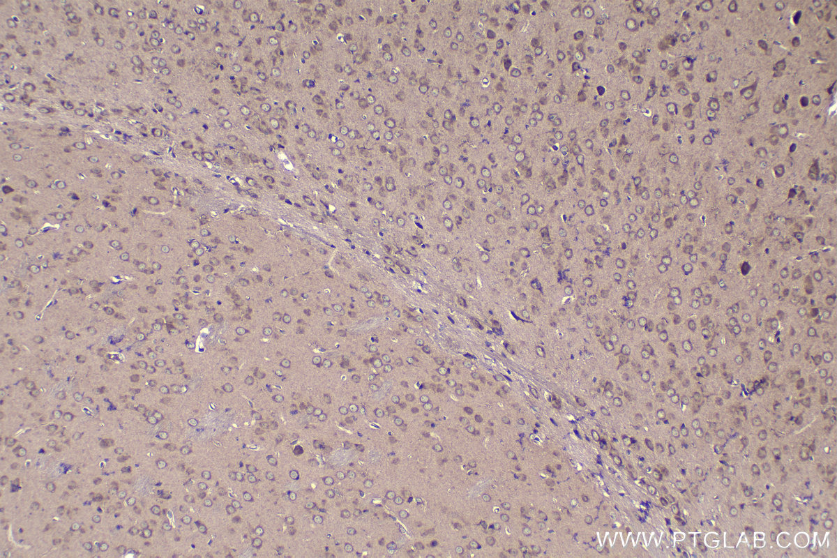 Immunohistochemical analysis of paraffin-embedded mouse brain tissue slide using KHC1108 (CTGF/CCN2 IHC Kit).