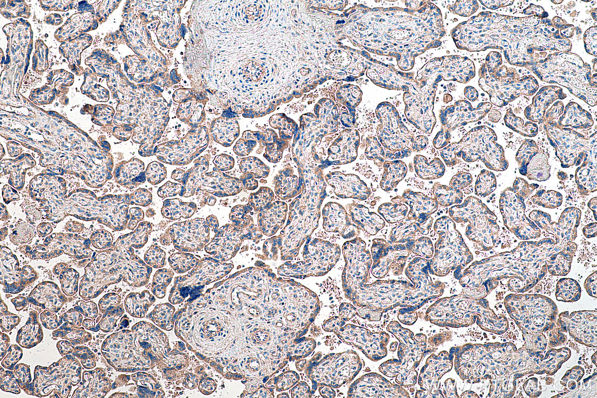 Immunohistochemical analysis of paraffin-embedded human placenta tissue slide using KHC0262 (CTNNA3 IHC Kit).