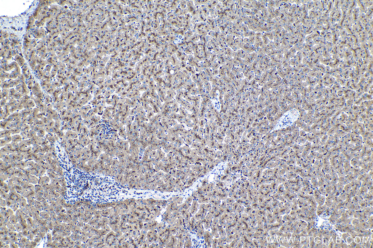 Immunohistochemical analysis of paraffin-embedded human liver tissue slide using KHC1125 (CTSA IHC Kit).