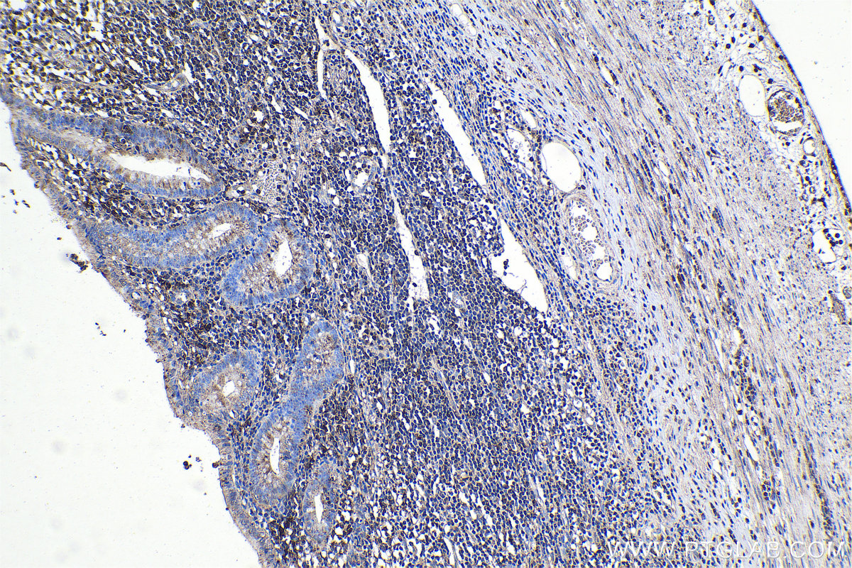 Immunohistochemical analysis of paraffin-embedded human appendicitis tissue slide using KHC1125 (CTSA IHC Kit).