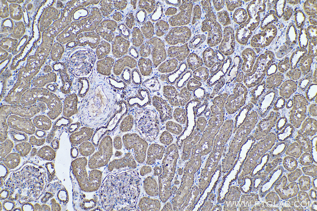 Immunohistochemical analysis of paraffin-embedded human kidney tissue slide using KHC0591 (Cathepsin D IHC Kit).