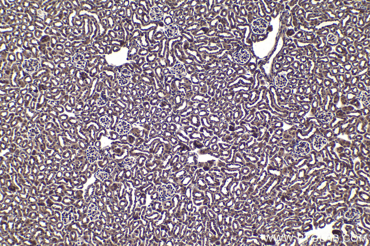 Immunohistochemical analysis of paraffin-embedded mouse kidney tissue slide using KHC1512 (CTSL1 IHC Kit).