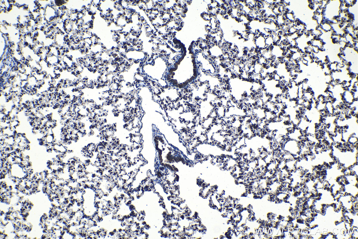 Immunohistochemical analysis of paraffin-embedded rat lung tissue slide using KHC1121 (CUGBP2 IHC Kit).