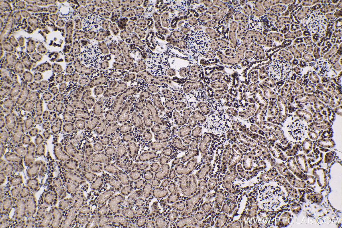 Immunohistochemical analysis of paraffin-embedded rat kidney tissue slide using KHC1590 (CUX1 IHC Kit).