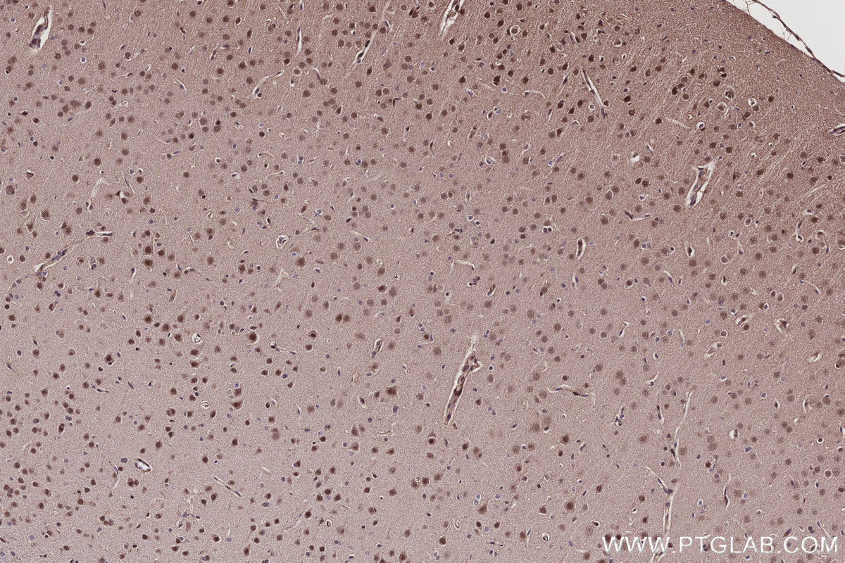 Immunohistochemical analysis of paraffin-embedded rat brain tissue slide using KHC3103 (CWF19L1 IHC Kit).