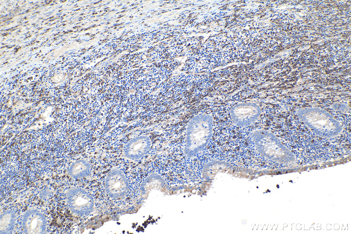 Immunohistochemical analysis of paraffin-embedded human appendicitis tissue slide using KHC1126 (CYBA IHC Kit).