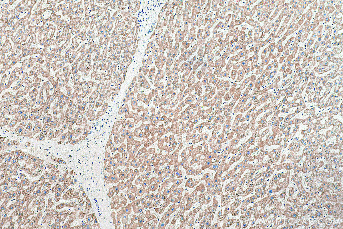 Immunohistochemical analysis of paraffin-embedded human liver tissue slide using KHC0245 (CYC1 IHC Kit).