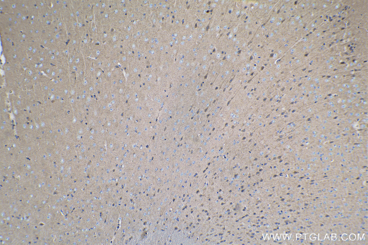 Immunohistochemical analysis of paraffin-embedded mouse brain tissue slide using KHC0253 (CYFIP2 IHC Kit).