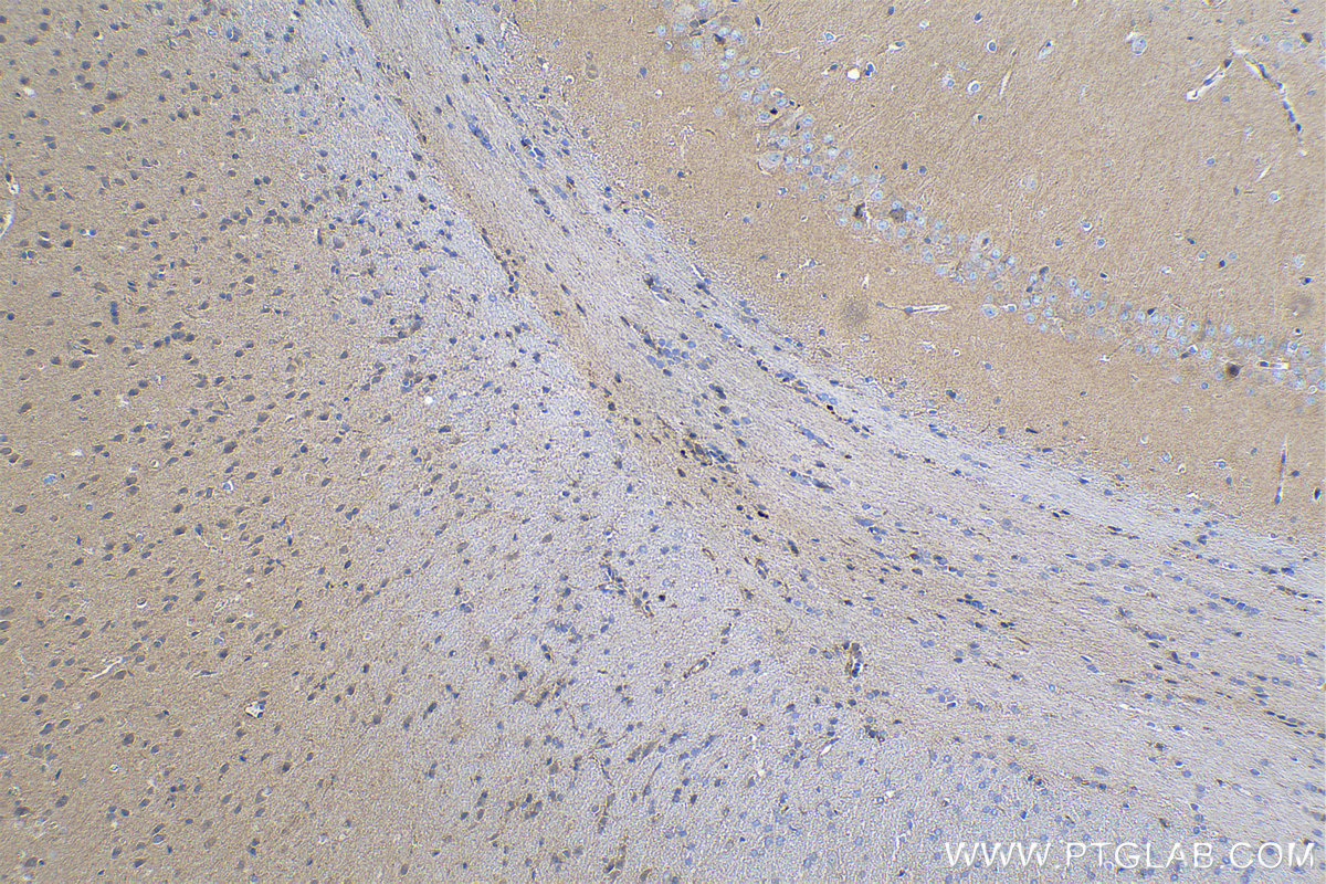 Immunohistochemical analysis of paraffin-embedded rat brain tissue slide using KHC0253 (CYFIP2 IHC Kit).