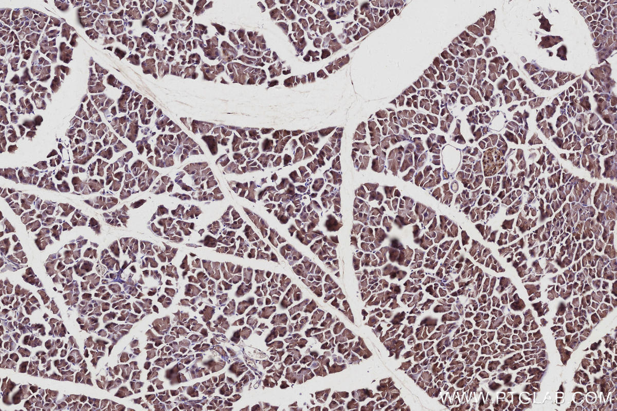 Immunohistochemical analysis of paraffin-embedded mouse pancreas tissue slide using KHC2940 (CYLD IHC Kit).