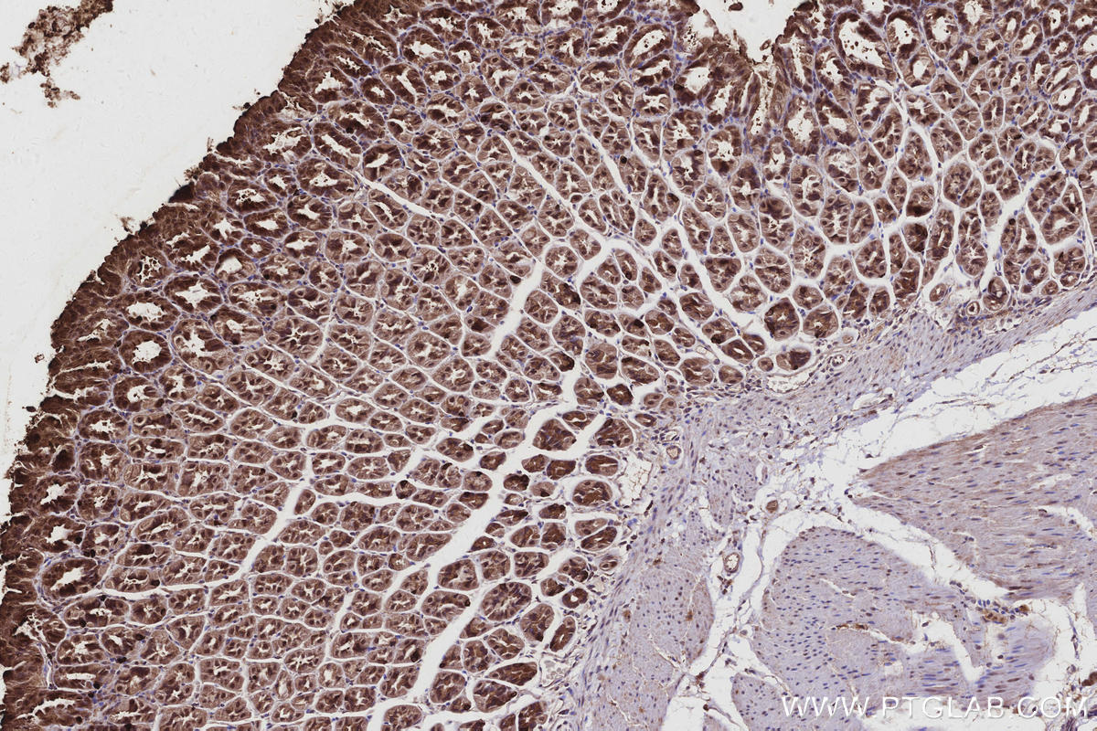 Immunohistochemical analysis of paraffin-embedded mouse stomach tissue slide using KHC2940 (CYLD IHC Kit).