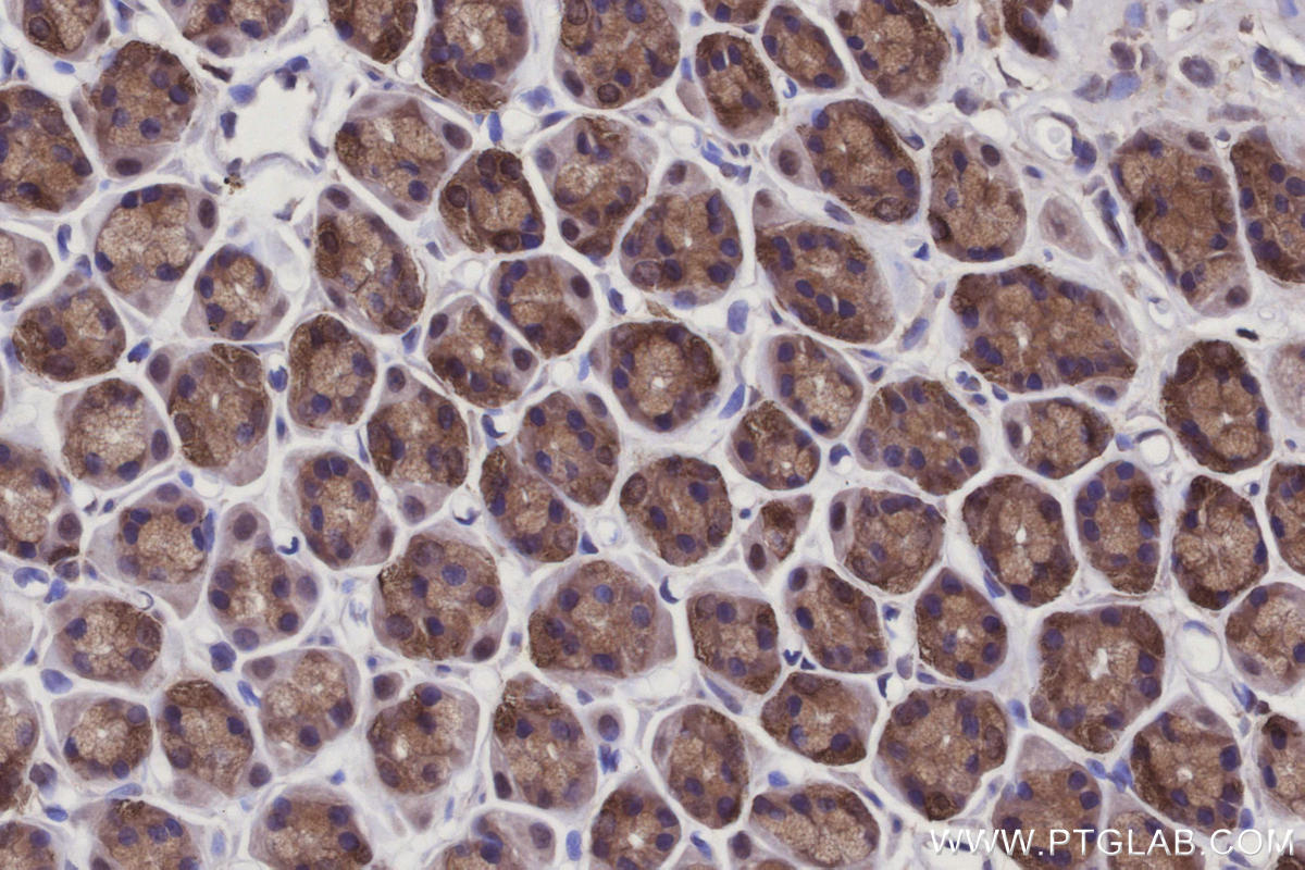 Immunohistochemical analysis of paraffin-embedded rat stomach tissue slide using KHC2940 (CYLD IHC Kit).