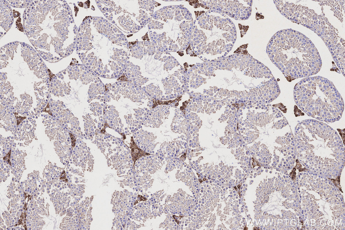 Immunohistochemical analysis of paraffin-embedded mouse testis tissue slide using KHC3170 (CYP11A1 IHC Kit).