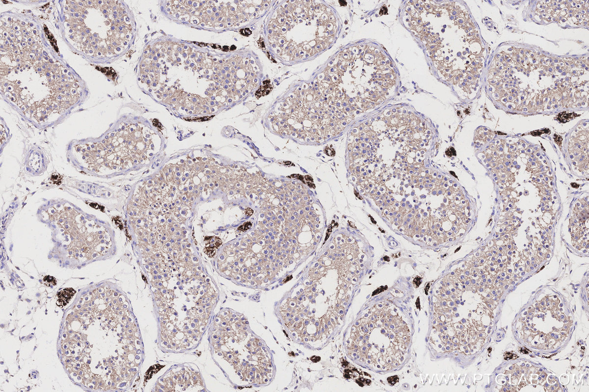 Immunohistochemical analysis of paraffin-embedded human testis tissue slide using KHC3170 (CYP11A1 IHC Kit).