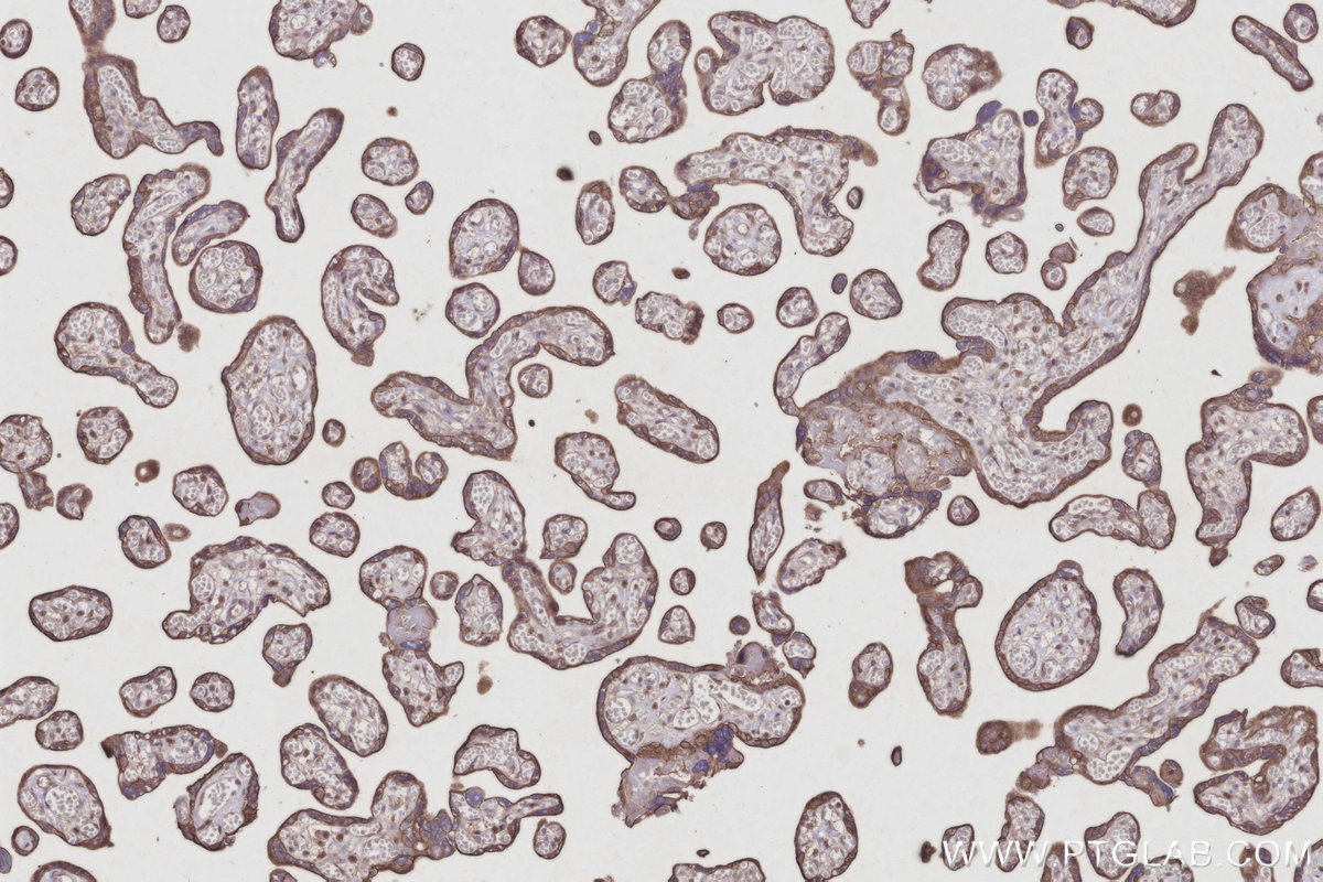 Immunohistochemical analysis of paraffin-embedded human placenta tissue slide using KHC2947 (CYP26B1 IHC Kit).