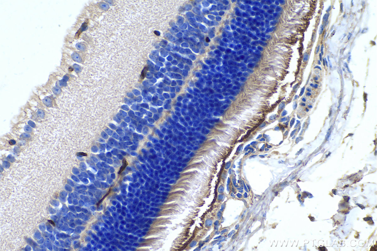 Immunohistochemical analysis of paraffin-embedded mouse eye tissue slide using KHC0494 (CYP27A1 IHC Kit).