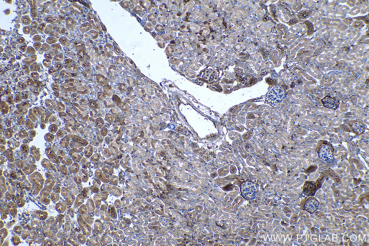 Immunohistochemical analysis of paraffin-embedded mouse kidney tissue slide using KHC0494 (CYP27A1 IHC Kit).