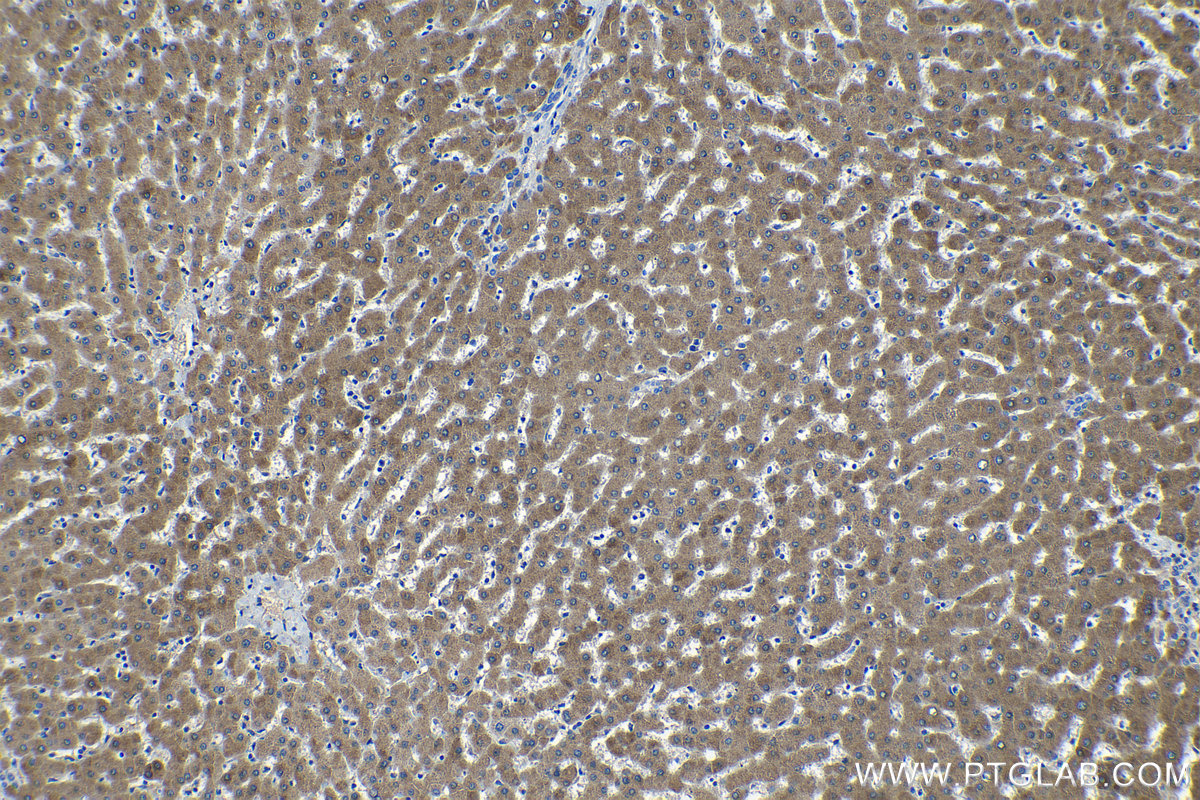 Immunohistochemical analysis of paraffin-embedded human liver tissue slide using KHC1208 (CYP2D6 IHC Kit).