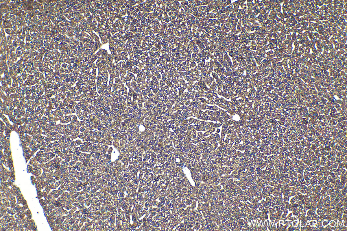 Immunohistochemical analysis of paraffin-embedded mouse liver tissue slide using KHC1208 (CYP2D6 IHC Kit).