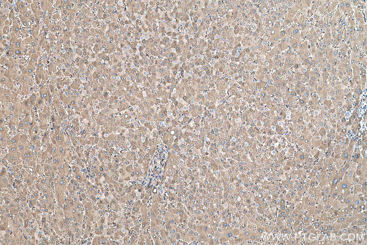 Immunohistochemical analysis of paraffin-embedded human liver tissue slide using KHC0477 (CYP2E1 IHC Kit).