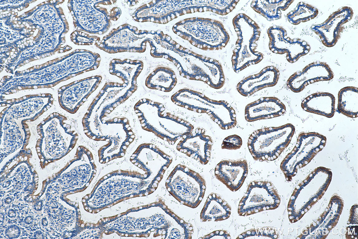 Immunohistochemical analysis of paraffin-embedded human small intestine tissue slide using KHC0413 (CYP2J2 IHC Kit).