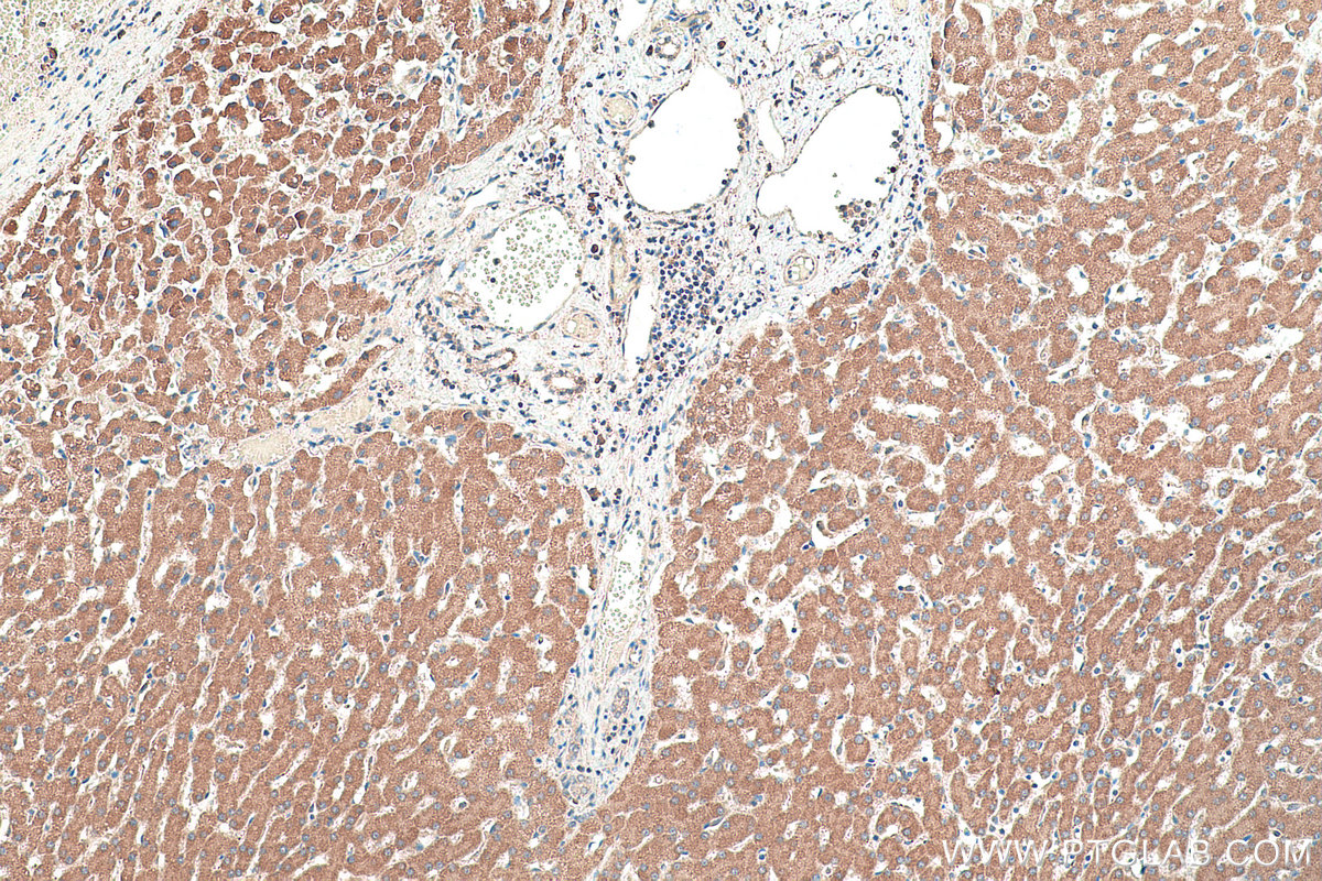 Immunohistochemical analysis of paraffin-embedded human liver tissue slide using KHC0413 (CYP2J2 IHC Kit).