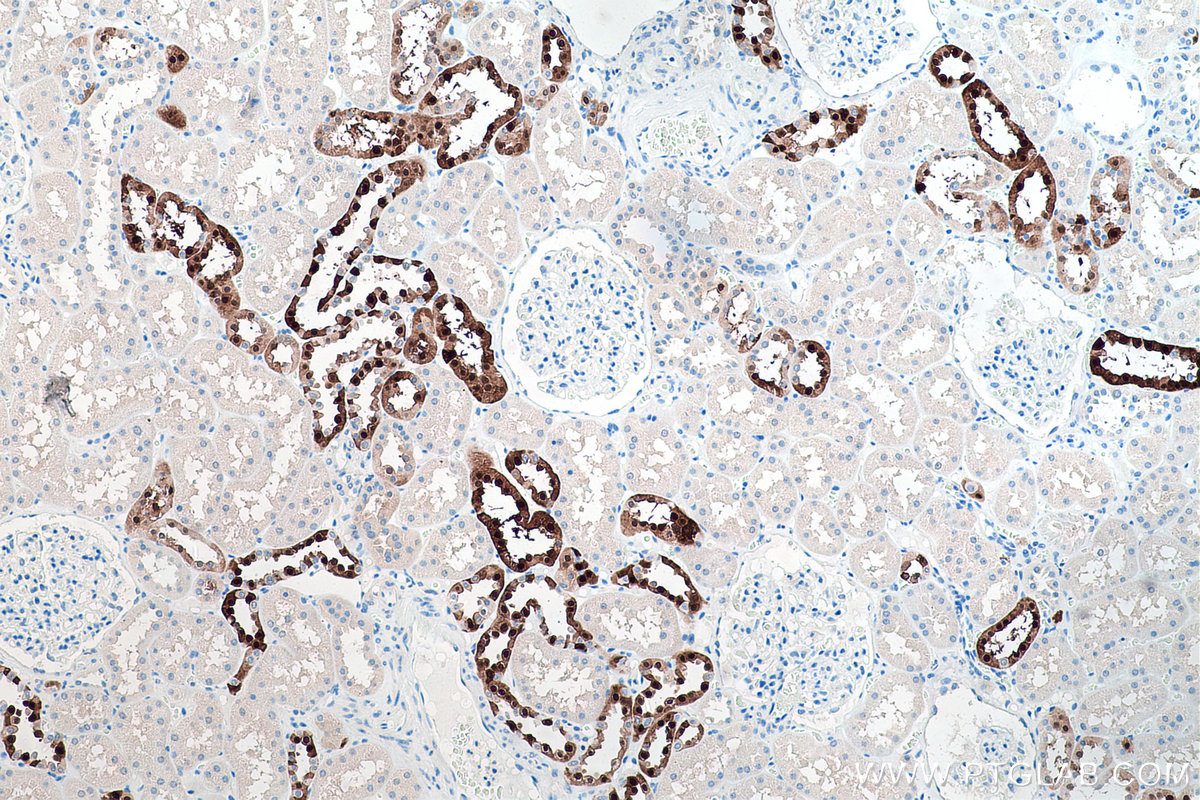 Immunohistochemical analysis of paraffin-embedded human kidney tissue slide using KHC0188 (Calbindin-D28k IHC Kit).