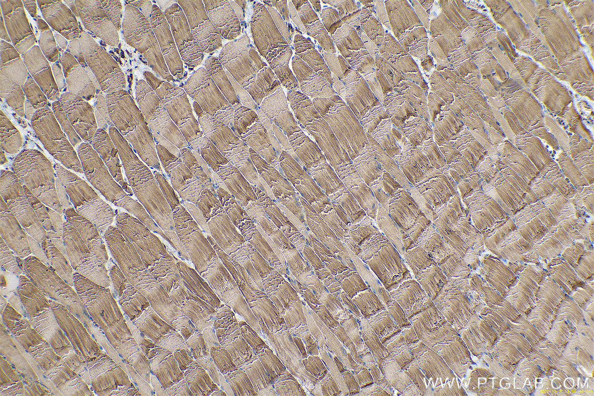 Immunohistochemical analysis of paraffin-embedded rat skeletal muscle tissue slide using KHC0572 (Calnexin IHC Kit).