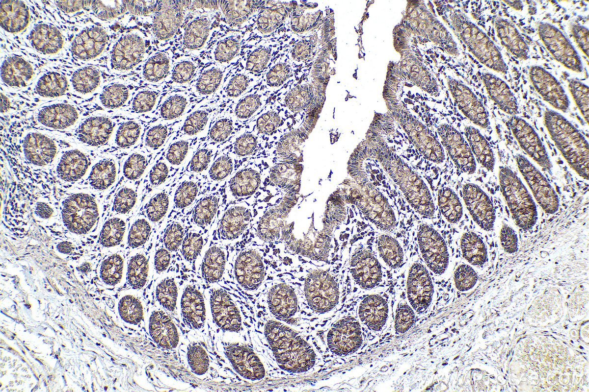 Immunohistochemical analysis of paraffin-embedded human colon tissue slide using KHC0373 (Cathepsin B IHC Kit).