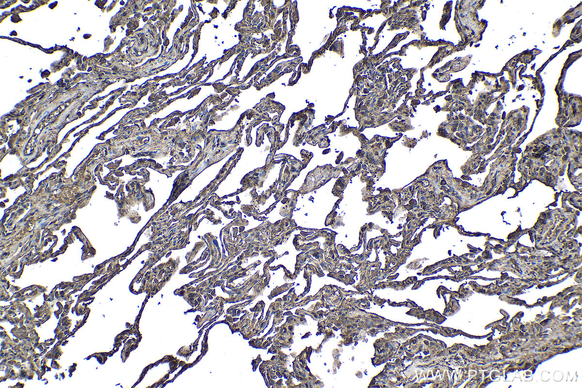 Immunohistochemical analysis of paraffin-embedded human lung tissue slide using KHC1122 (Ceruloplasmin/CP IHC Kit).