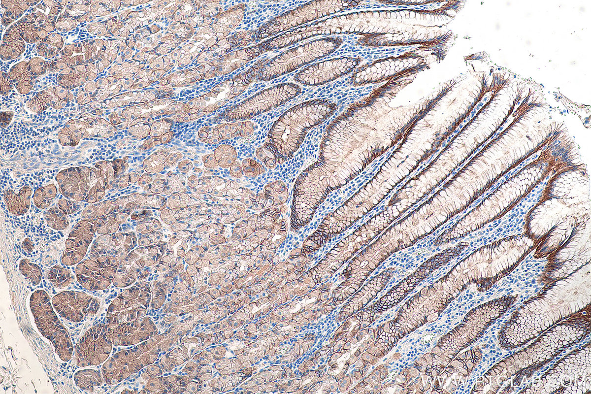 Immunohistochemical analysis of paraffin-embedded human stomach tissue slide using KHC0063 (Claudin 18 IHC Kit).