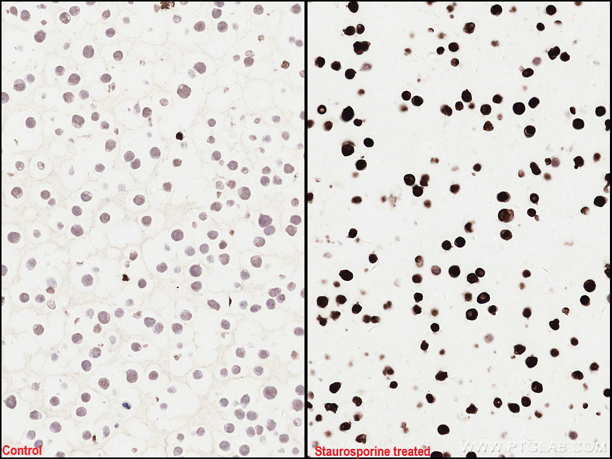 Immunohistochemical analysis of paraffin-embedded Jurkat cells slide using KHC2512 (Cleaved PARP1 IHC Kit).