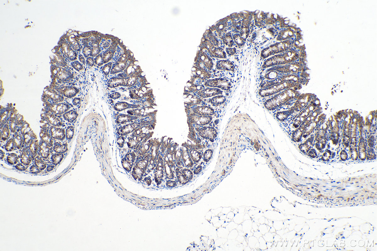 Immunohistochemical analysis of paraffin-embedded mouse colon tissue slide using KHC0128 (Cortactin IHC Kit).