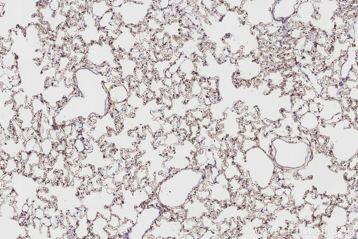 Immunohistochemical analysis of paraffin-embedded rat lung tissue slide using KHC3190 (Cytochrome P450 IHC Kit).
