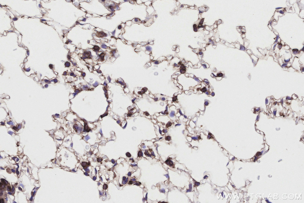 Immunohistochemical analysis of paraffin-embedded mouse lung tissue slide using KHC3190 (Cytochrome P450 IHC Kit).