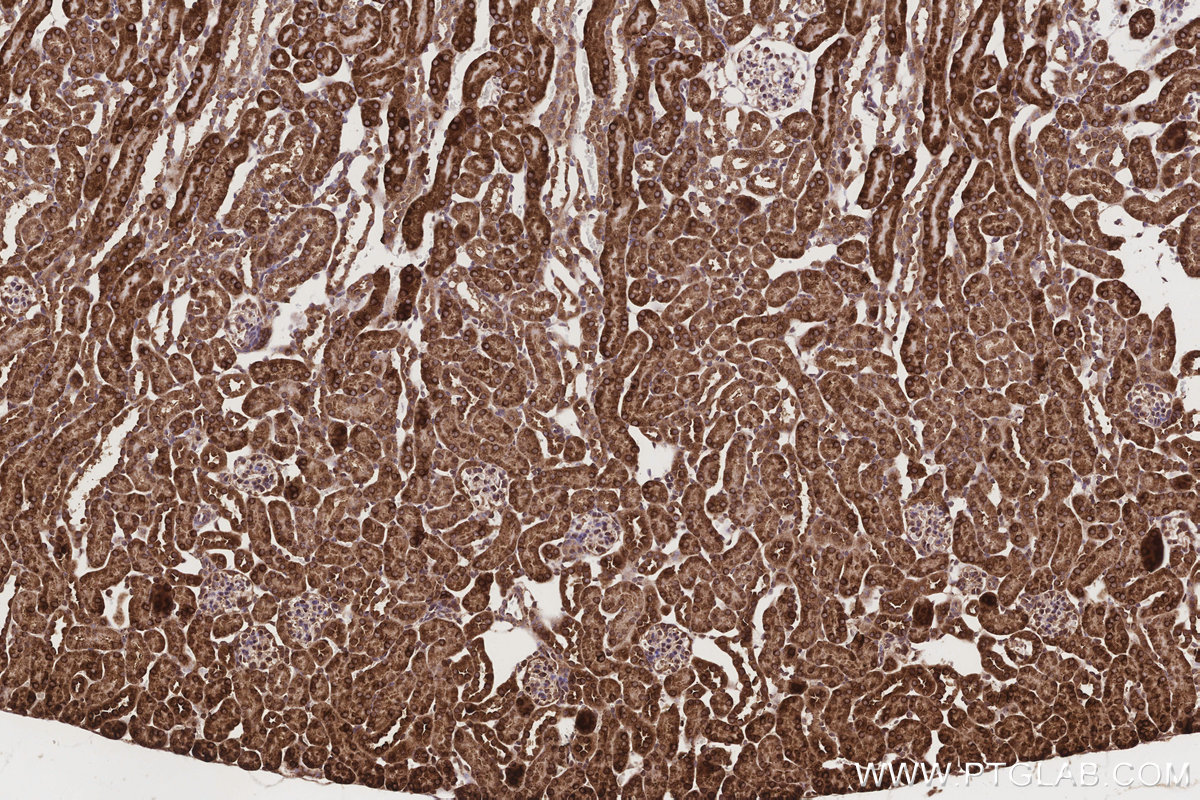 Immunohistochemical analysis of paraffin-embedded mouse kidney tissue slide using KHC3190 (Cytochrome P450 IHC Kit).