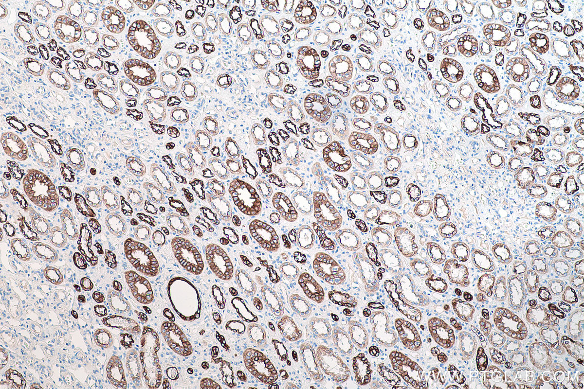 Immunohistochemical analysis of paraffin-embedded human kidney tissue slide using KHC0204 (Cytokeratin 7 IHC Kit).