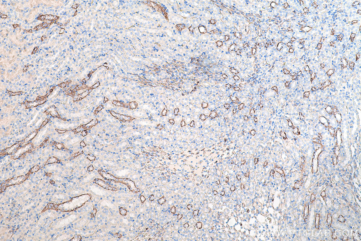 Immunohistochemical analysis of paraffin-embedded mouse kidney tissue slide using KHC0204 (Cytokeratin 7 IHC Kit).