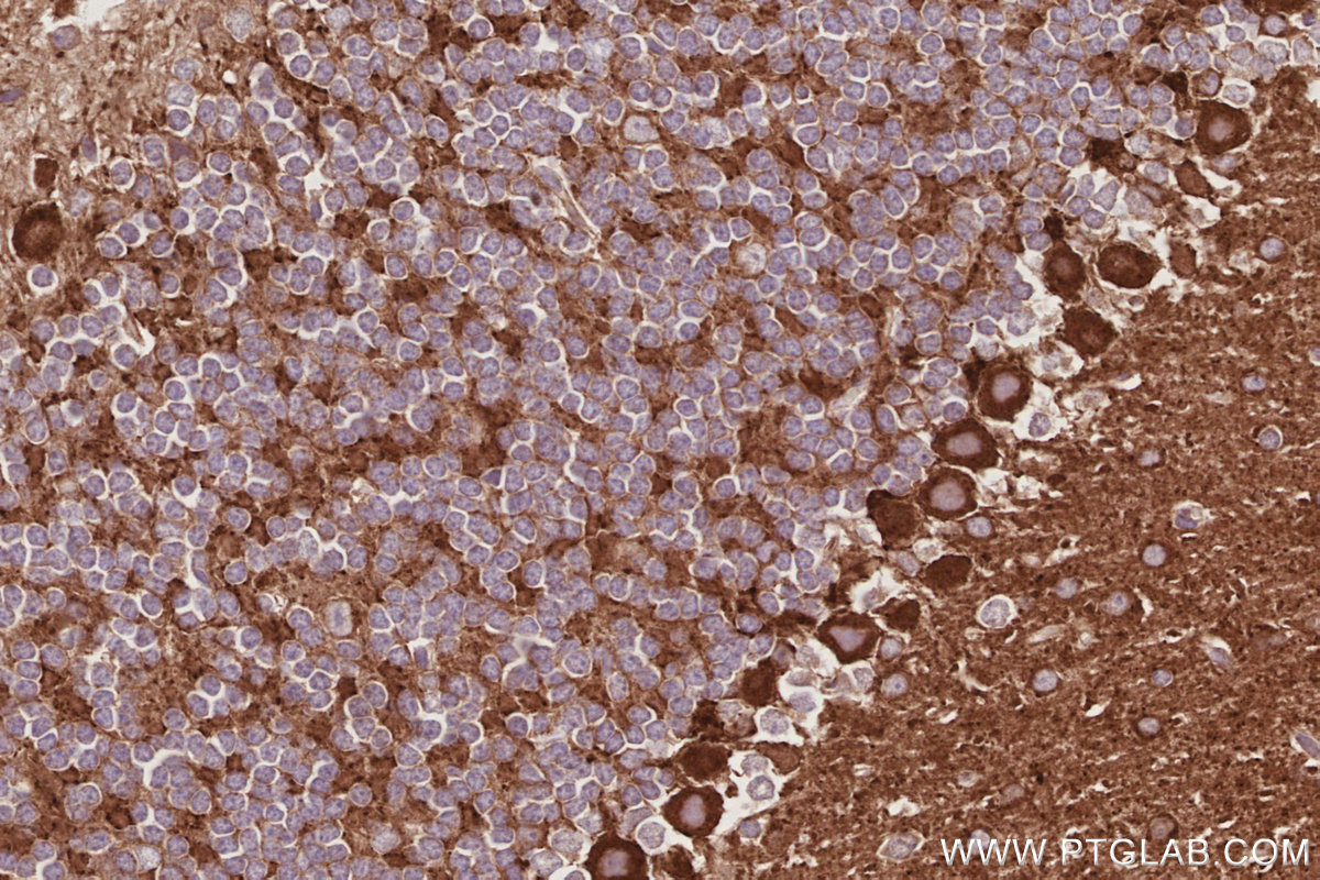 Immunohistochemical analysis of paraffin-embedded mouse cerebellum tissue slide using KHC3071 (DAAM1 IHC Kit). Immunohistochemical analysis of paraffin-embedded mouse cerebellum tissue slide using KHC3071 (DAAM1 IHC Kit).