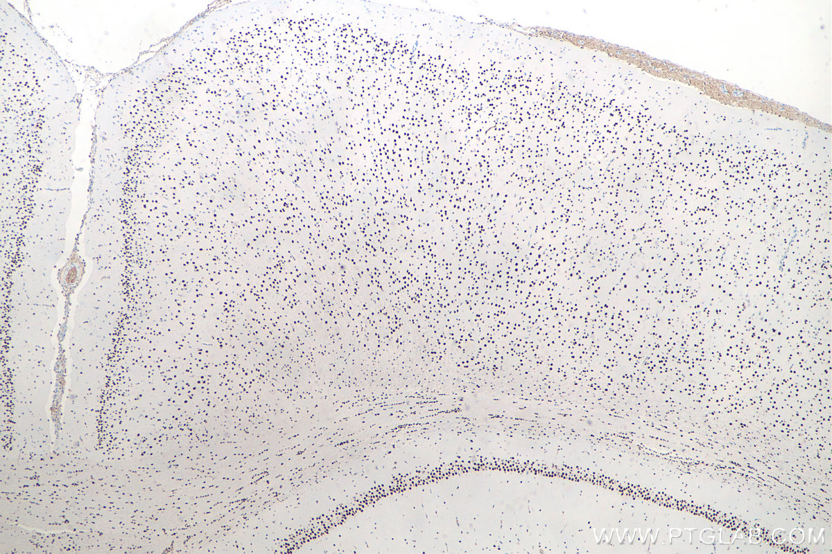 Immunohistochemical analysis of paraffin-embedded rat brain tissue slide using KHC0055 (DACH1 IHC Kit).