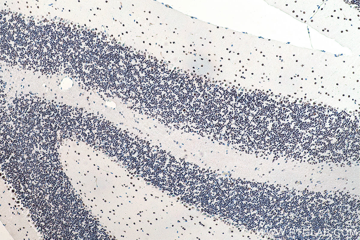 Immunohistochemical analysis of paraffin-embedded mouse cerebellum tissue slide using KHC0055 (DACH1 IHC Kit).