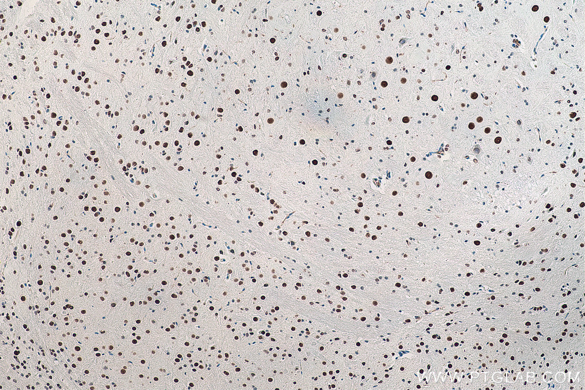 Immunohistochemical analysis of paraffin-embedded mouse cerebellum tissue slide using KHC0055 (DACH1 IHC Kit).